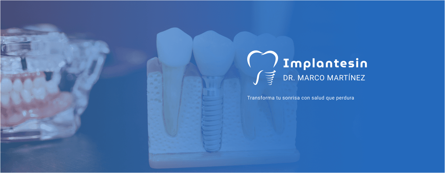 Dientes, dentista en culiacán, implantesin. Banner principal con dientes de fondo