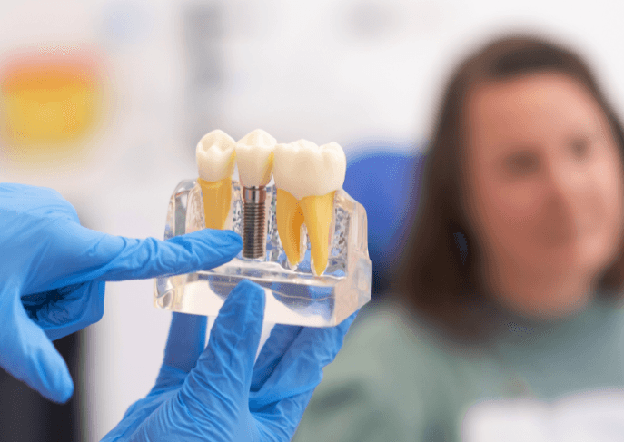 Dientes, dentista en culiacán, implantesin. Banner principal con dientes de fondo